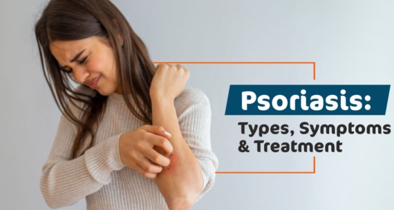 Understanding Psoriasis: Types, Symptoms, and Treatment